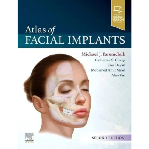 Atlas of Facial Implants Atlas of Facial Implants (Original PDF & Videos)